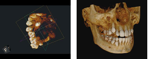 3-d imaging computer photos